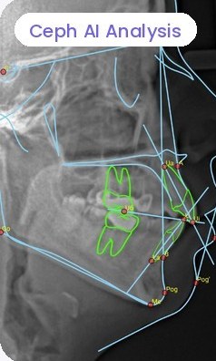 A ceph traced by Ceph AI Analysis