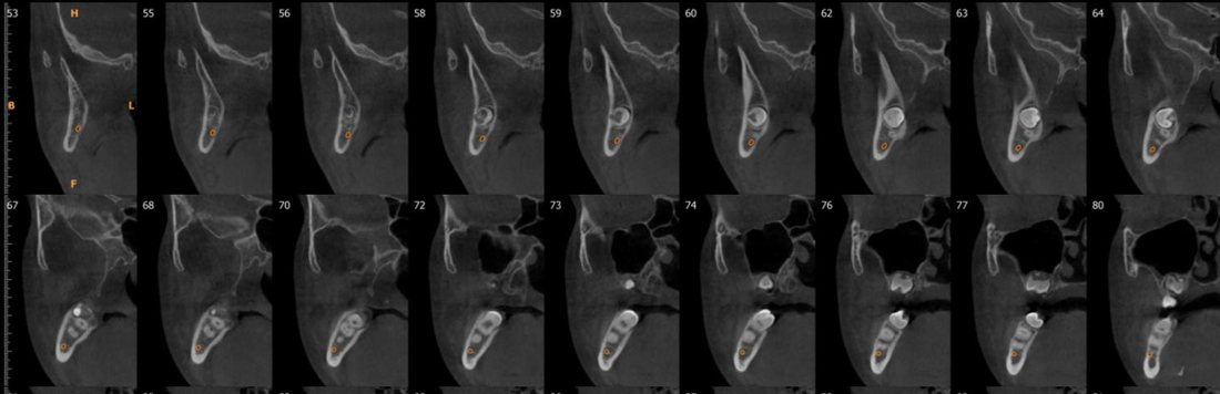 CBCT cross-sections
