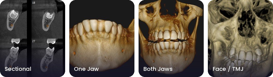 CBCT views in the Dentread viewer: sectional, one jaw, both jaws, and face and TMJ